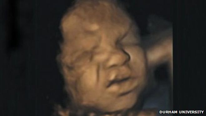 Sự thật thú vị: thai nhi đã biết khóc ngay khi còn trong bụng mẹ